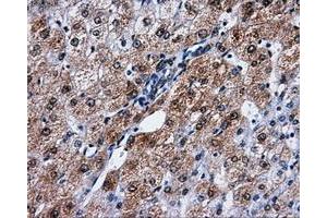 Immunohistochemical staining of paraffin-embedded liver tissue using anti-PPME1mouse monoclonal antibody. (PPME1 anticorps)