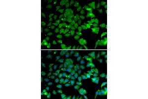 Immunofluorescence analysis of U20S cell using NAA10 antibody.