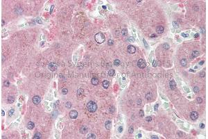 Rabbit Anti-NNMT antibody   Formalin Fixed Paraffin Embedded Tissue: Human Adult Liver  Observed Staining: Cytoplasm in hepatocytes Primary Antibody Concentration: 1:600 Secondary Antibody: Donkey anti-Rabbit-Cy3 Secondary Antibody Concentration: 1:200 Magnification: 20X Exposure Time: 0.