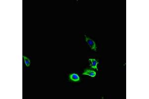 Immunofluorescent analysis of U251 cells using ABIN7163626 at dilution of 1:100 and Alexa Fluor 488-congugated AffiniPure Goat Anti-Rabbit IgG(H+L)