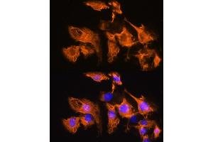 Immunofluorescence analysis of C6 cells using  Rabbit pAb (ABIN7265482) at dilution of 1:100. (ARF4 anticorps  (AA 1-180))