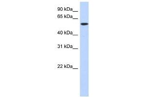 DNTT antibody used at 1 ug/ml to detect target protein. (TdT anticorps  (Middle Region))