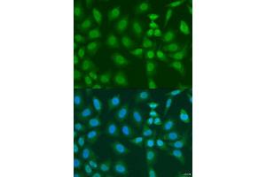 Immunofluorescence analysis of U2OS cells using PHF21B antibody. (PHF21B anticorps  (AA 322-531))