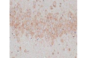 Immunohistochemistry of paraffin-embedded Rat brain using TMX1 Polyclonal Antibody at dilution of 1:100 (40x lens). (TMX1 anticorps)