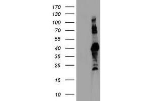 Western Blotting (WB) image for anti-Ring Finger Protein 113B (RNF113B) antibody (ABIN1500715) (RNF113B anticorps)