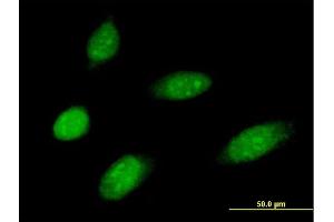 Immunofluorescence of purified MaxPab antibody to MMS19 on HeLa cell. (MMS19 anticorps  (AA 1-293))