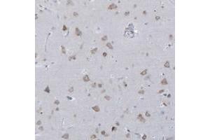Immunohistochemical staining of human cerebral cortex with CCNJ polyclonal antibody  shows moderate cytoplasmic positivity in neuronal cells. (Cyclin J anticorps)