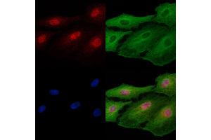 ABIN7094781 and ABIN7098832 staining  cells by IF/ICC.