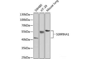 Western blot analysis of extracts of various cell lines using SERPINA1 Polyclonal Antibody at dilution of 1:1000. (SERPINA1 anticorps)