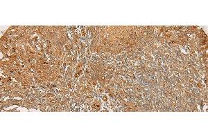 Immunohistochemistry of paraffin-embedded Human tonsil tissue using FLNC Polyclonal Antibody at dilution of 1:30(x200)