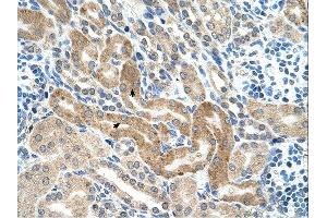 CHAF1B antibody was used for immunohistochemistry at a concentration of 4-8 ug/ml. (CHAF1B anticorps)