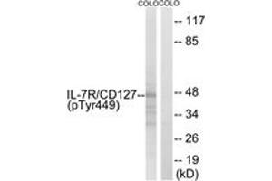 Western blot analysis of extracts from COLO205 cells, using IL-7R/CD127 (Phospho-Tyr449) Antibody. (IL7R anticorps  (pTyr449))