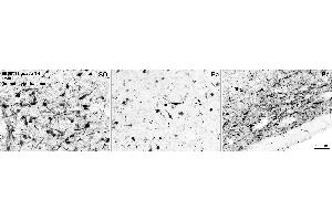 EB6739 (0. (Tyrosine Hydroxylase anticorps  (C-Term))