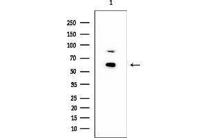 Western blot analysis of lysates from PC12 cells, using Cytochrome P450 2A13 Mouse Monoclonal Antibody at 1/1000 dilution.