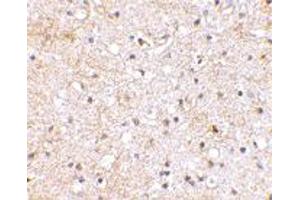 Immunohistochemical staining of human brain tissue using GRIK1 polyclonal antibody  at 2. (GRIK1 anticorps  (C-Term))