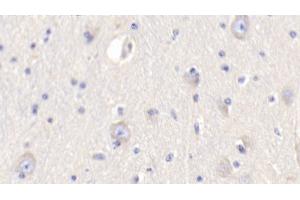 anti-Resistin (RETN) (AA 19-109) antibody