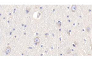 Detection of RETN in Bovine Cerebrum Tissue using Polyclonal Antibody to Resistin (RETN) (Resistin anticorps  (AA 19-109))
