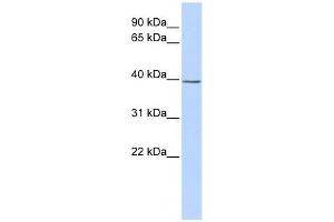 SETD3 antibody used at 0. (SETD3 anticorps  (Middle Region))
