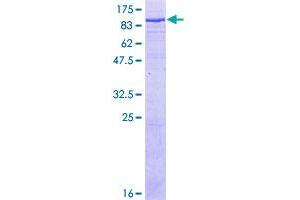 Transferrin (TF) (AA 1-698) protein (GST tag)