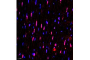 Immunofluorescence of paraffin embedded rat heart using SMNDC1 (ABIN7075773) at dilution of 1:650 (400x lens)