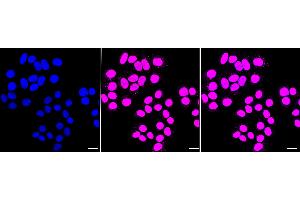 Immunocytochemical staining of HepG2 cells with Histone deacetylase 8 antibody (ABIN7798936), 1:1,000).