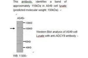Image no. 1 for anti-Adenylate Cyclase 9 (ADCY9) antibody (ABIN790779) (ADCY9 anticorps)
