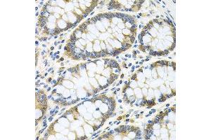 Immunohistochemistry of paraffin-embedded human colon using GNE antibody.