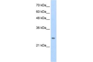 Western Blotting (WB) image for anti-Homeobox B7 (HOXB7) antibody (ABIN2461724)