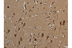 The image on the left is immunohistochemistry of paraffin-embedded Human brain tissue using ABIN7191019(HSPG2 Antibody) at dilution 1/50, on the right is treated with synthetic peptide.