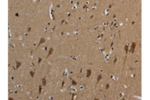 The image on the left is immunohistochemistry of paraffin-embedded Human brain tissue using ABIN7191019(HSPG2 Antibody) at dilution 1/50, on the right is treated with synthetic peptide. (HSPG2 anticorps)