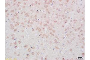 Formalin-fixed and paraffin embedded rat brain tissue labeled with Anti- TPH (Ser19) Polyclonal Antibody, Unconjugated(ABIN2179763) 1:200 followed by conjugation to the secondary antibody and DAB staining (Tryptophan Hydroxylase 2 anticorps  (pSer19))