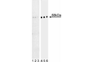 Western blot analysis of BLNK (pY84) in human Burkitt’s lymphoma. (B-Cell Linker anticorps  (pTyr84))