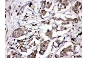 IHC analysis of PKC alpha using anti-PKC alpha antibody (ABIN3043549).