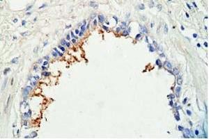 Human lung tissue was staned by Rabbit Anti-AdrenomeduIIiln (1-44) (Human) Antibody (Adrenomedullin anticorps  (AA 1-44))