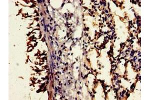 Immunohistochemistry of paraffin-embedded human lung tissue using ABIN7148376 at dilution of 1:100 (CD55 anticorps  (AA 35-126))