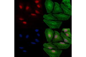 Phospho-MSH2 (Tyr238) Antibody staining A549 cells(heat shock treatment) by IF/ICC. (MSH2 anticorps  (pTyr238))