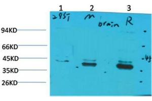 Western Blot (WB) analysis of 1)293T, 2)Mouse Brain Tissue, 3) Rat Brain Tissue with CABP2 Rabbit Polyclonal Antibody diluted at 1:2000. (CABP2 anticorps)