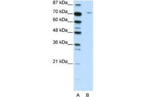 Western Blotting (WB) image for anti-Leucine Zipper, Putative Tumor Suppressor 1 (LZTS1) antibody (ABIN2461908) (LZTS1 anticorps)
