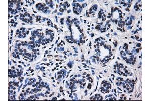 Immunohistochemical staining of paraffin-embedded breast tissue using anti-RPA2 mouse monoclonal antibody. (RPA2 anticorps)