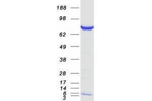 Validation with Western Blot