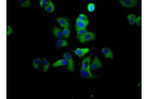 Immunofluorescence staining of MCF-7 cells with ABIN7143399 at 1:133, counter-stained with DAPI. (Adhesion G Protein-Coupled Receptor G1 (ADGRG1) (AA 26-216) anticorps)