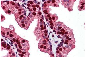 anti-RAB23, Member RAS Oncogene Family (RAB23) (C-Term) antibody