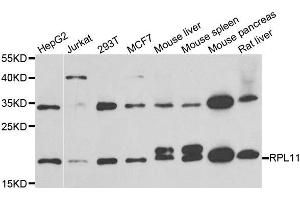 Western blot analysis of extracts of various cell lines, using RPL11 antibody.