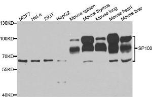 Western blot analysis of extracts of various cell lines, using SP100 antibody. (SP100 anticorps)