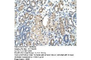 Rabbit Anti-PBEF1 Antibody  Paraffin Embedded Tissue: Human Kidney Cellular Data: Epithelial cells of renal tubule Antibody Concentration: 4. (NAMPT anticorps  (C-Term))