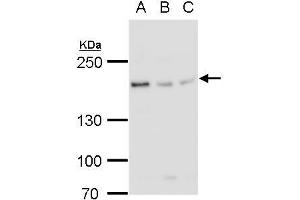 WB Image BLM antibody detects BLM protein by western blot analysis. (BLM anticorps  (N-Term))