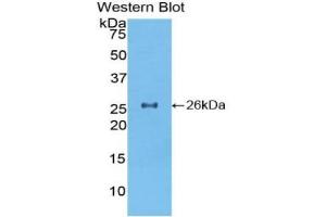 Detection of Recombinant TOR2A, Mouse using Polyclonal Antibody to Torsin 2A (TOR2A) (TOR2A anticorps  (AA 125-313))