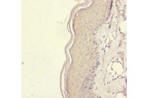 Immunohistochemistry of paraffin-embedded human skin tissue using ABIN7167451 at dilution of 1:100