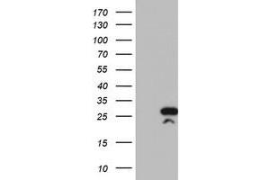 Western Blotting (WB) image for anti-Regulator of G-Protein Signaling 16 (RGS16) antibody (ABIN1500694) (RGS16 anticorps)