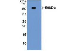 Detection of Recombinant ITGb2, Human using Polyclonal Antibody to Integrin Beta 2 (CD18) (Integrin beta 2 anticorps  (AA 124-363))